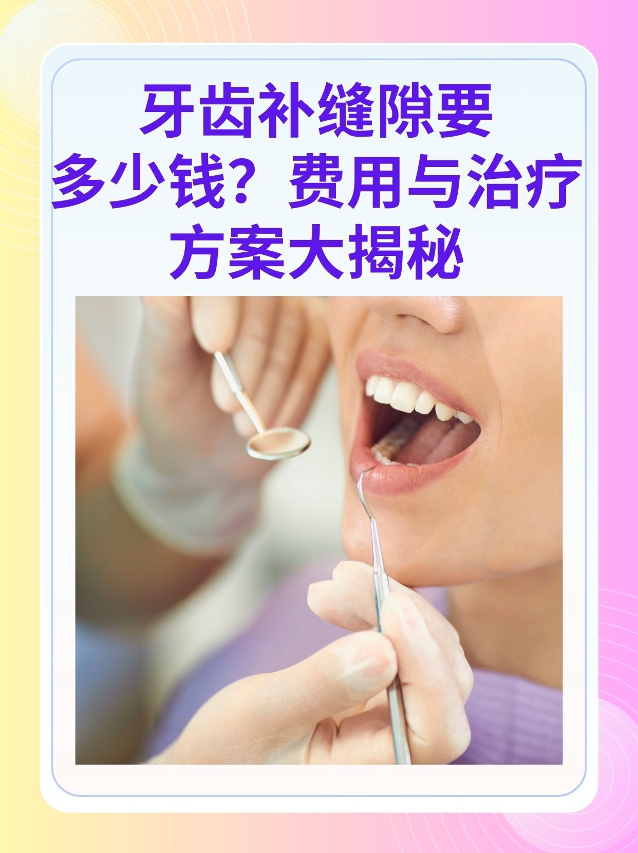 大庆补牙医保可以报销吗(补牙医保可以报销吗 哪些可以报销呢)